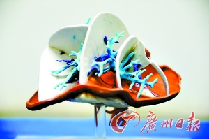 ,3D打印,3D打印可以“脱胎换骨”：我国实现骨科领域临床应用