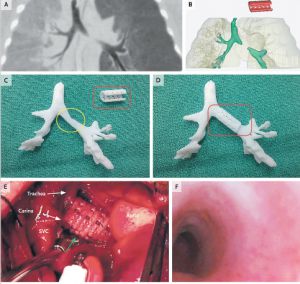 1369304154_122812_1369304361_noticia_normal.jpg ,3D打印,一两月大的婴儿因3D 打印机得救