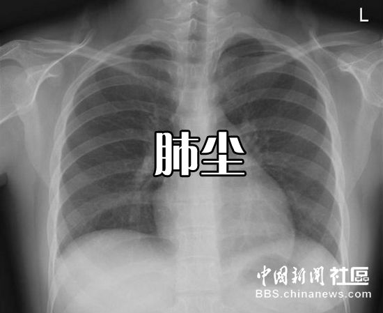 ,网民,网易,网友为PM2.5起中文名 太有才了