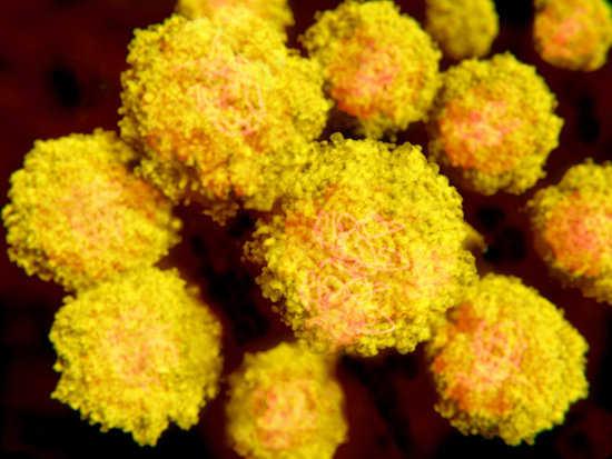 ,IBM研制出“解药”对抗各种病毒性疾病