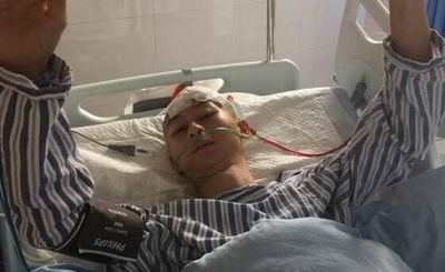 ,不是失误，不是科幻电影，男子开颅手术中突然苏醒