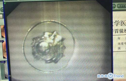 今日热点：冠军夫妻吵架 北京住房租赁新政