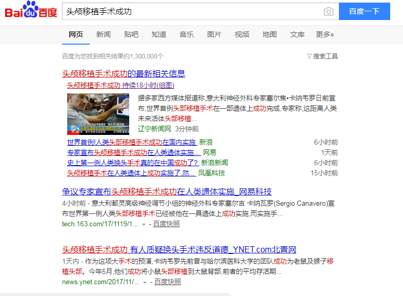 ,准备好了吗？世界首例换头成功