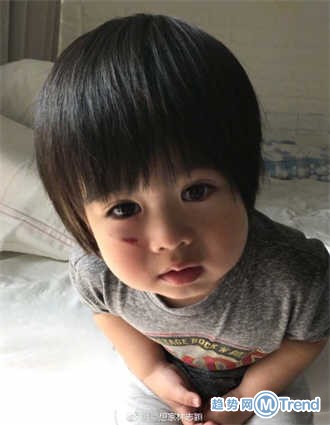 今日热点：林志颖儿子跌伤脸 男孩只身扑灭山火