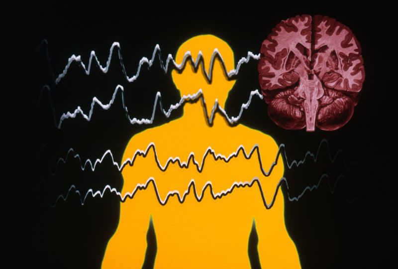 epilepsy1200-800x540.jpg ,植入性脑装置可以防止癫痫发作