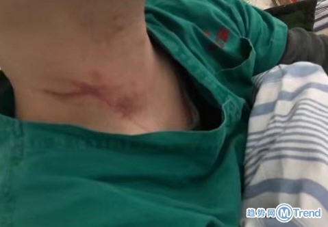 今日热点：有患者4次检测才确诊 武汉两名医生被患者家属打伤