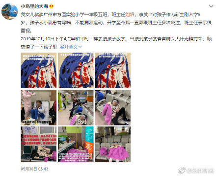 警方和教育局通报教师涉嫌体罚学生