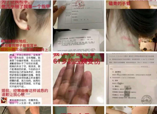 热点：中国驻意大利使馆发布紧急提示 张培萌妻子称只想要女儿抚养权