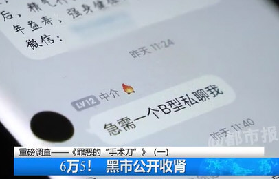 肾贩子6万5收肾转卖80万