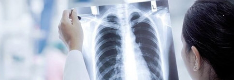 重症白肺死亡率40%以上