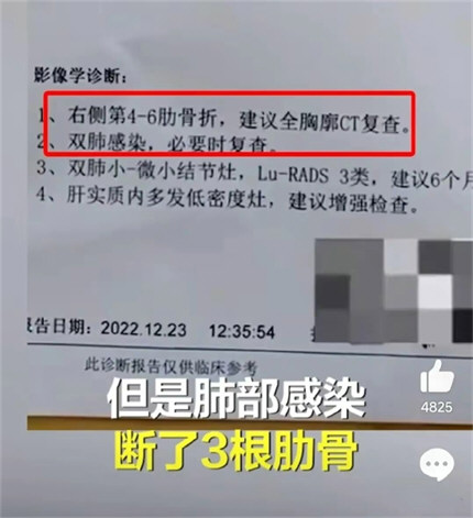 男子阳了双肺感染咳断三根肋骨
