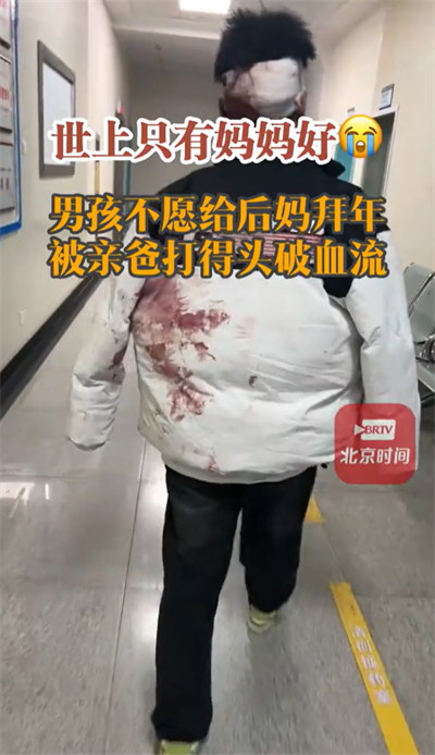 男孩不愿给后妈拜年 被亲爸打破头
