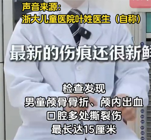 医生举报3岁男童疑遭生父虐待