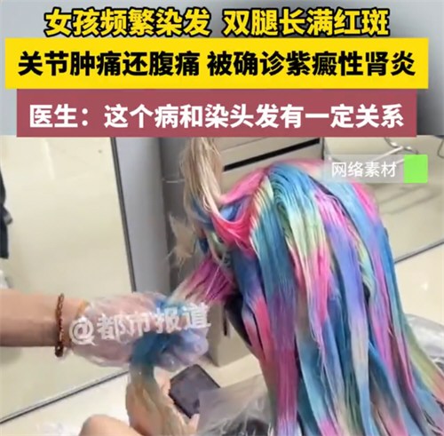 00后女生追星频繁染发患肾病
