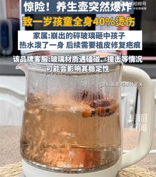养生壶爆 炸1岁孩童全身40%烫伤