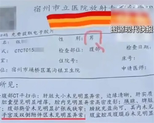 男子腹部CT检出子宫