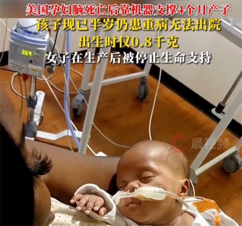 美女子脑死亡后因堕胎禁令被迫产子