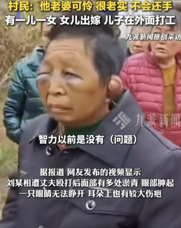 女子遭75岁丈夫殴打村民发声 女子遭75岁丈夫殴打村民发声