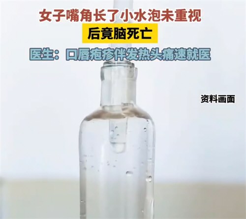 女子嘴角起泡未重视竟脑死亡
