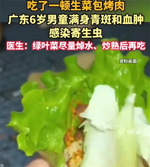 6岁男童吃生菜后血肿感染寄生虫