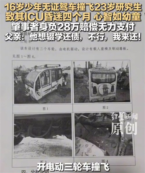 23岁研究生遭遇车祸心智如幼童
