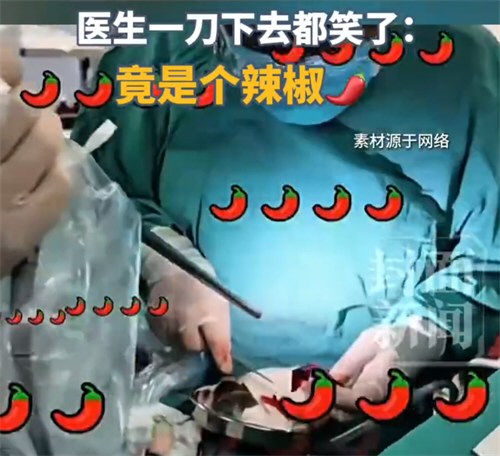 大爷查出肺癌结果是辣椒卡肺里了