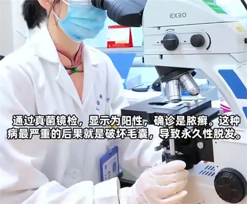 5岁女孩每天抱小兔子致永久性脱发