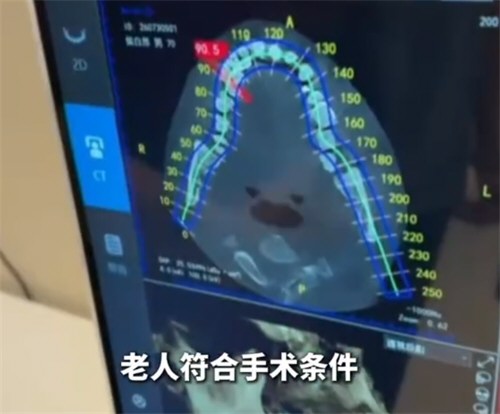 老人两天被拔21颗牙卫健委称未违规