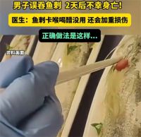 男子误吞5cm鱼刺用土方身亡 	误吞鱼刺后可尝试咳嗽咳出