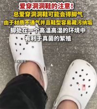洞洞鞋长期穿可能致真菌感染 洞洞鞋可能会导致足弓塌陷