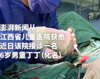 6岁男童小区内被犬只撕咬下体 男童被狗咬重伤