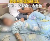 6岁娃光脚踩到死鱼进了ICU 光脚踩沙滩感染创伤弧菌