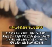 女演员打白发针2个月效果甚微 白发针真能拯救白发吗？