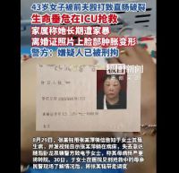 女子遭前夫殴打致肠破裂住进ICU 警方回应女子被前夫打进ICU