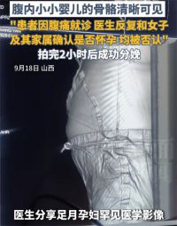 19岁女子腹痛就诊后2小时分娩 女子否认怀孕影像检查2小时后分娩