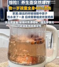 养生壶爆 炸1岁孩童全身40%烫伤 商家回应养生壶致1岁孩童烫伤