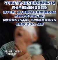 被戳伤失明男孩家长回应获赔272万 男孩被戳伤左眼老师涂猪油消肿致感染