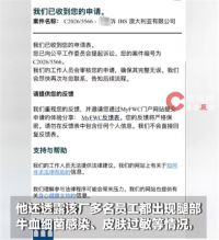 中国男子举报澳洲肉厂安全问题被辞 男子澳洲肉厂工作腿部感染红肿
