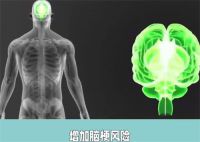 平均睡眠7小时却3年出现2次脑梗 周末过度补觉可能危害更大