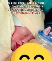 女子孕19周胎儿小脚外露险掉出 39岁女子第4次怀孕19周胎儿险掉出