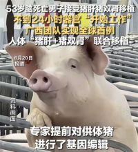 53岁脑死亡男子接受猪肝猪双肾移植 全球首例人体猪肝猪双肾联合移植