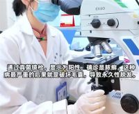 5岁女孩每天抱小兔子致永久性脱发 与小动物接触后要注意清洁