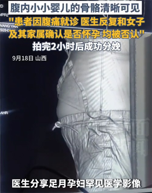19岁女子腹痛就诊后2小时分娩
