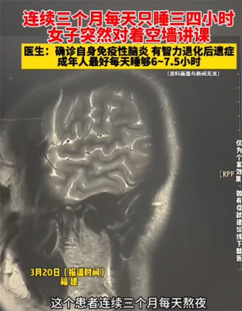 女子熬夜3个月突然开始对墙讲课 25岁的年龄70岁的褪黑素水平