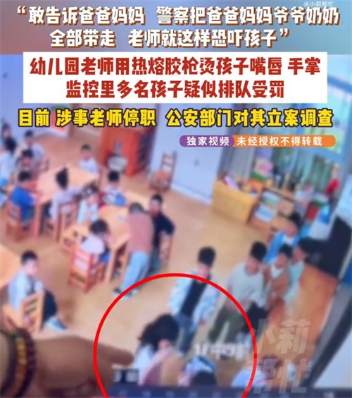 多名幼儿园小朋友被老师用热熔胶烫伤 幼儿被幼师恐吓虐待