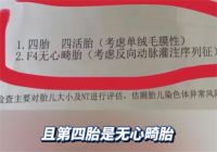 女子怀孕每次产检发现多出一胎 辽宁一孕妇两个月内从一胎变四胞胎