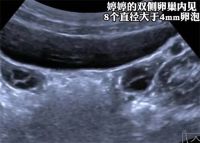 7岁女童3个月猛蹿4cm确诊性早熟 孩子长太快要警惕性早熟