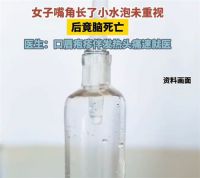 女子嘴角起泡未重视竟脑死亡 医生提醒口唇疱疹伴发热头痛速就医